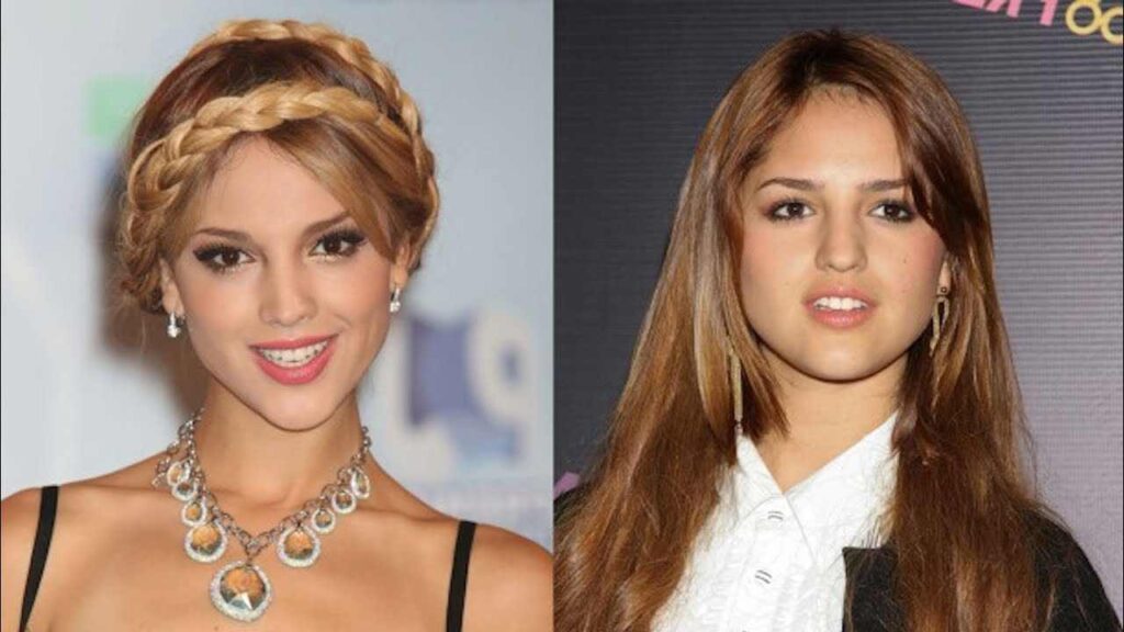 Eiza González “Plastic Surgery Addict” Rumors – How Many Procedures Has